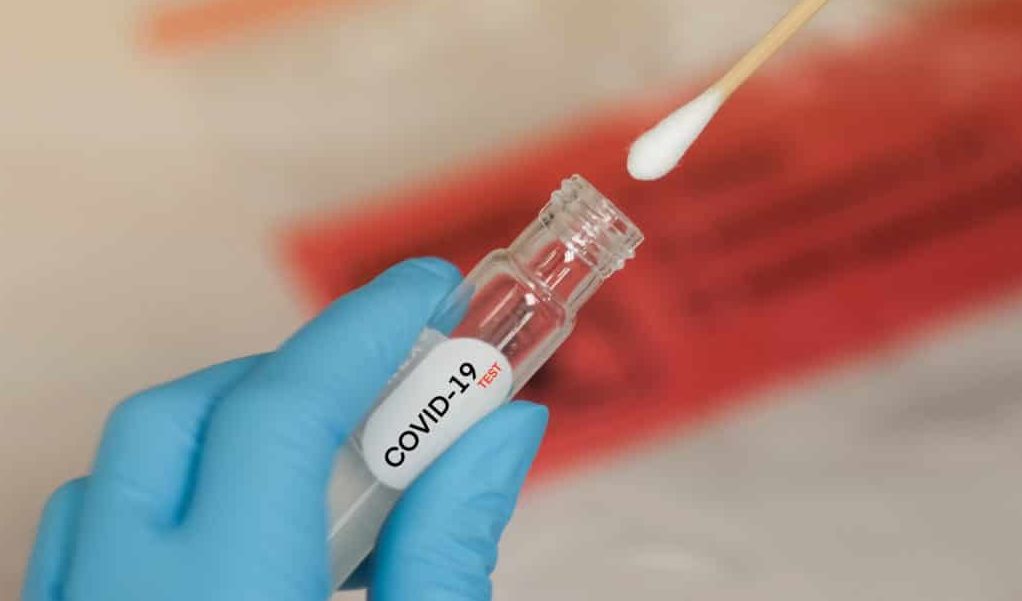 Pcr swab test